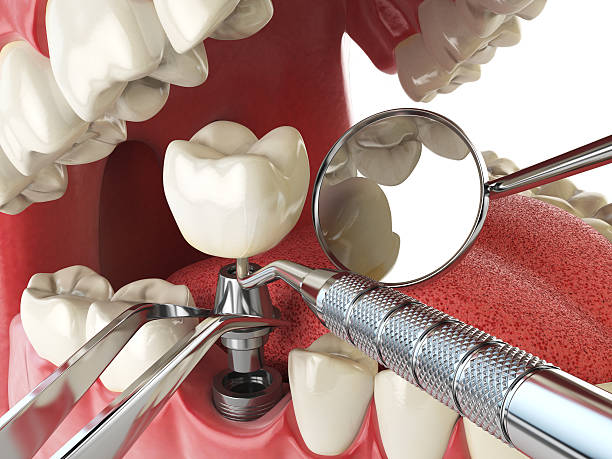 Best Urgent Dental Care for Toothache in Petersburg, WV