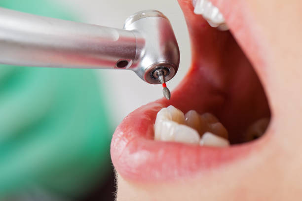 Best Holiday Emergency Dentist in Petersburg, WV